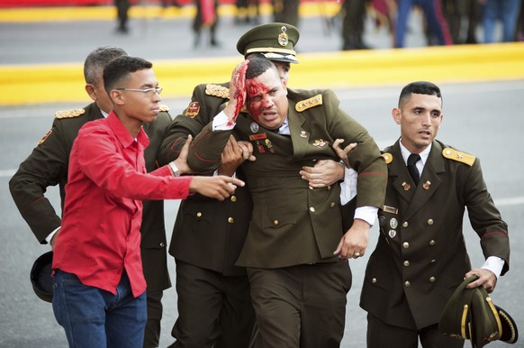 In this photo released by China&#039;s Xinhua News Agency, an uniformed official bleeds from the head following an incident during a speech by Venezuela&#039;s President Nicolas Maduro in Caracas, Ven ...