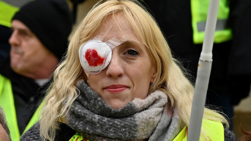Einige Protestierende trugen, wie diese Frau, Augenklappen,&nbsp;um an Verletzte zu erinnern, die bei Protesten ein Auge verloren hatten.&nbsp;