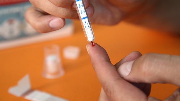 Ab Herbst 2018 soll nach Plaenen des Bundesgesundheitsministeriums jeder selbst testen koennen, ob er mit dem HI-Virus infiziert ist. (Foto: HIV-Schnelltest, nach einem kleinen Pieks in den Finger wir ...